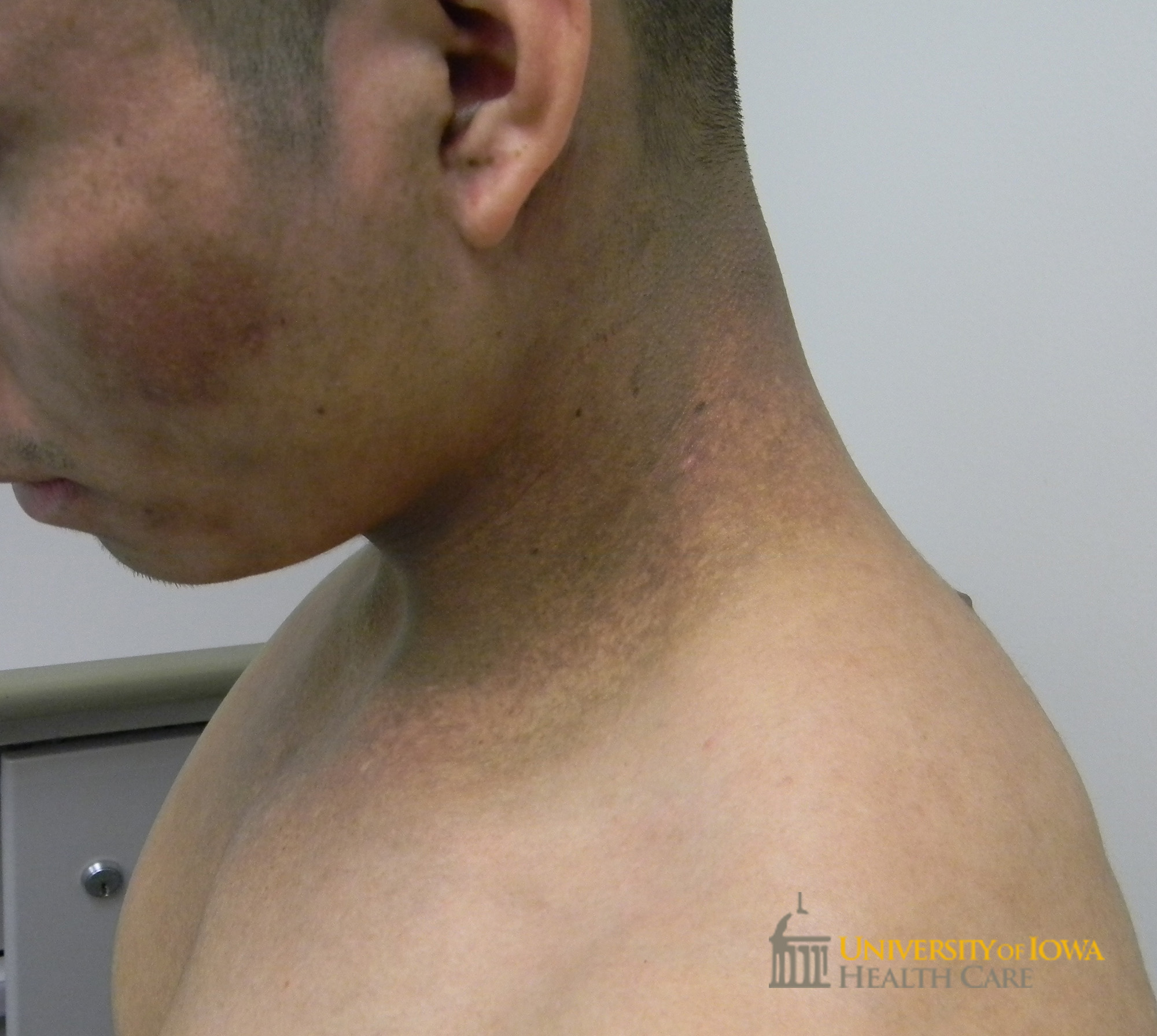 Brown-gray ill-defiend patches on the cheeks and neck. (click images for higher resolution).